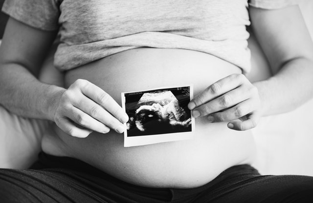 Down Sendromu Kürtaj Yasası Kapsamında Hafta Sınırlaması Var Mı?  